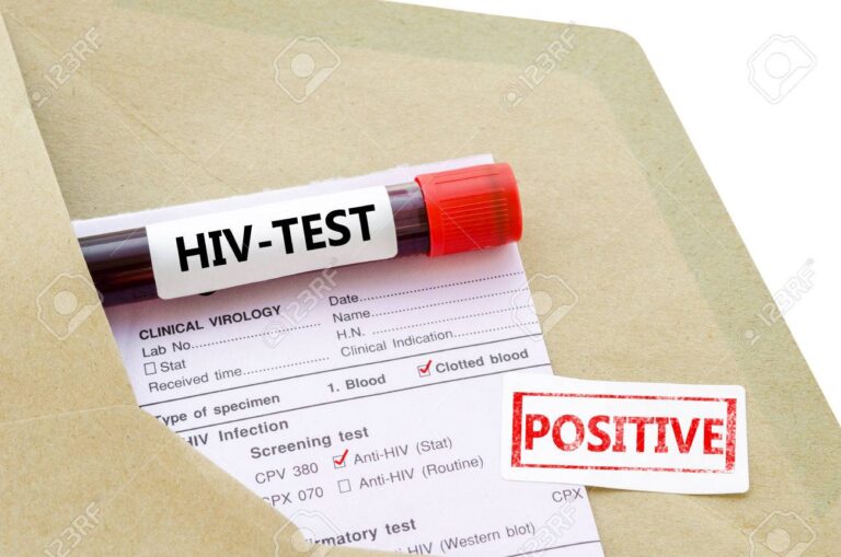 Santé : Hausse du VIH en Afrique suite aux coupes d’aide américaines